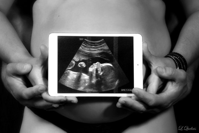 16 PORTRAITS GROSSESSE